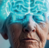 alzheimer