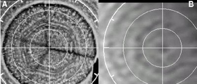 Saturns Nordpolar-Hexagon in der Aufnahme der Voyager-Sonde